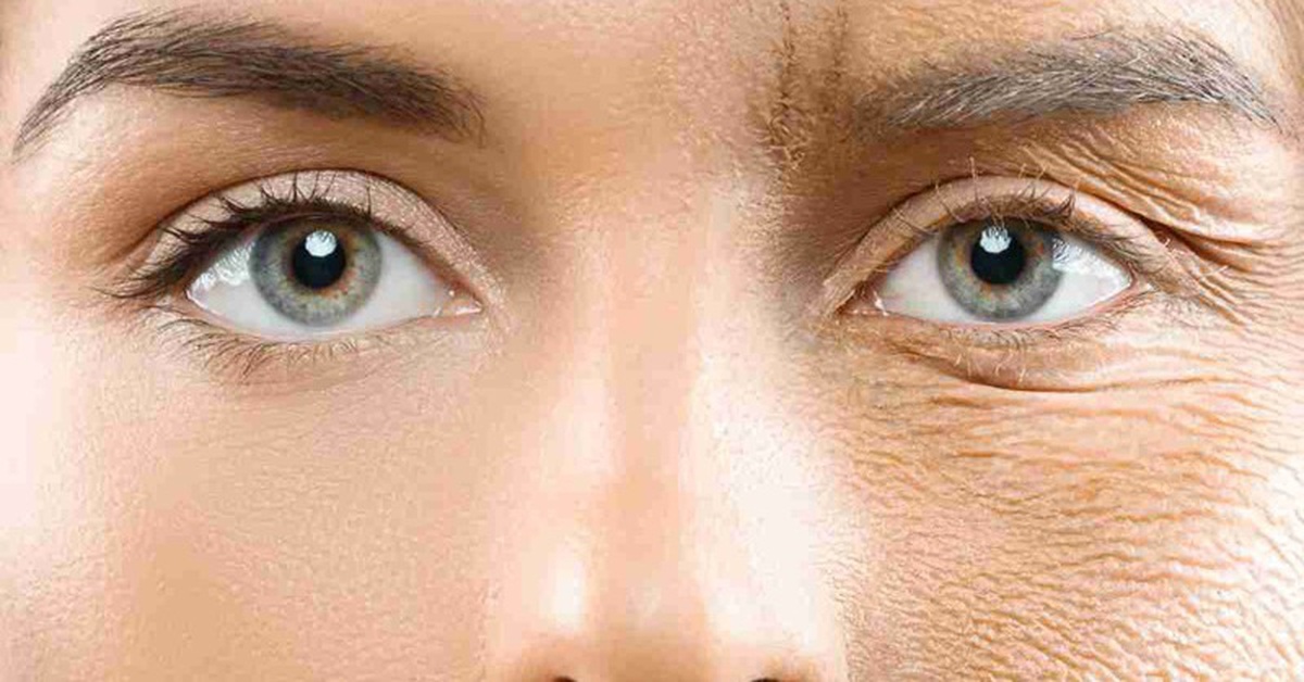 Serum tự làm từ phèn chua và vitamin E giúp xóa nếp nhăn vĩnh viễn?