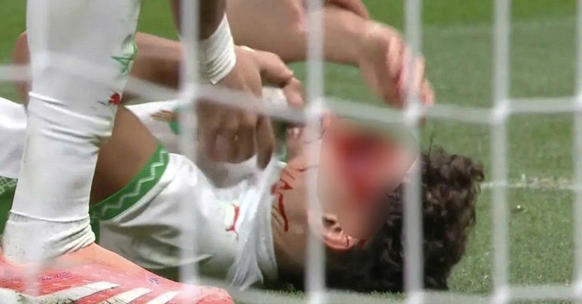 Ngôi sao Morocco dính chấn thương kinh hoàng ở trận chung kết AFCON