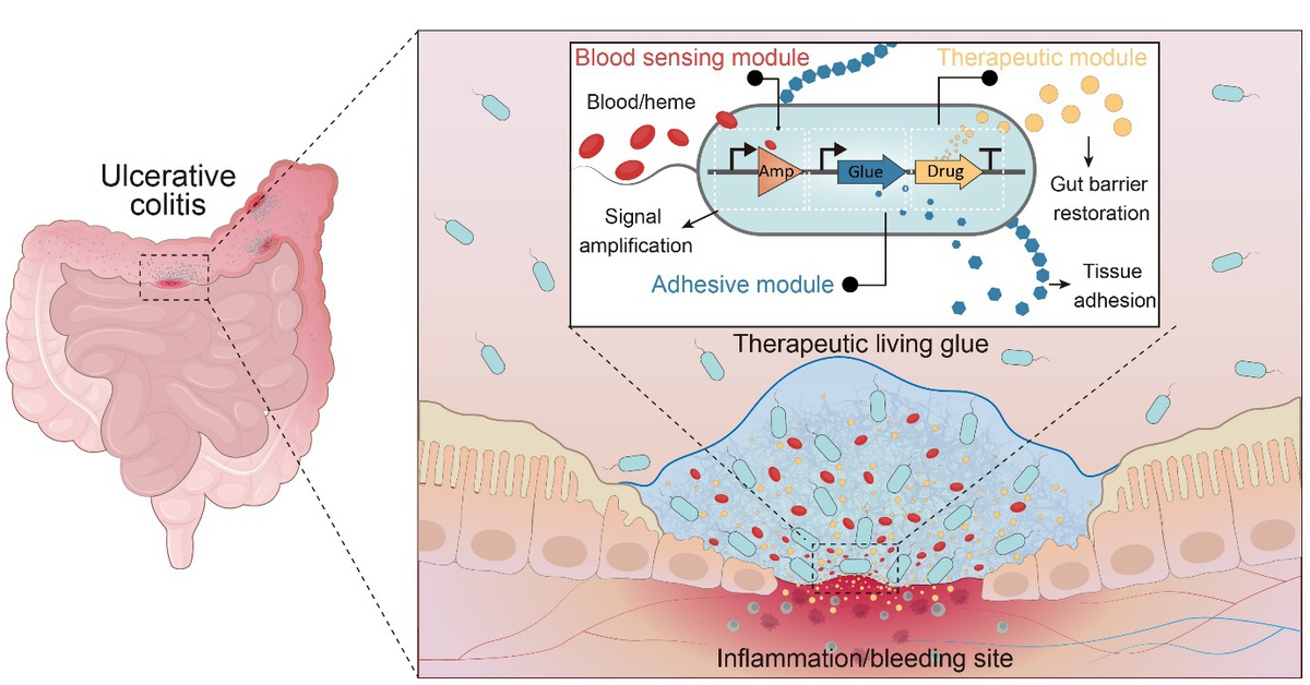 ‘Keo sống thông minh’ có khả năng tự tìm và vá tổn thương ruột