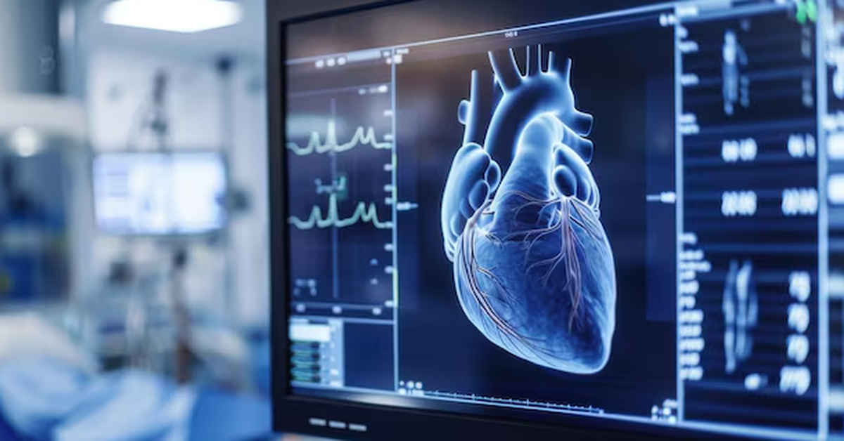 Đột phá: AI phát hiện bệnh tim chỉ từ một hình ảnh siêu âm