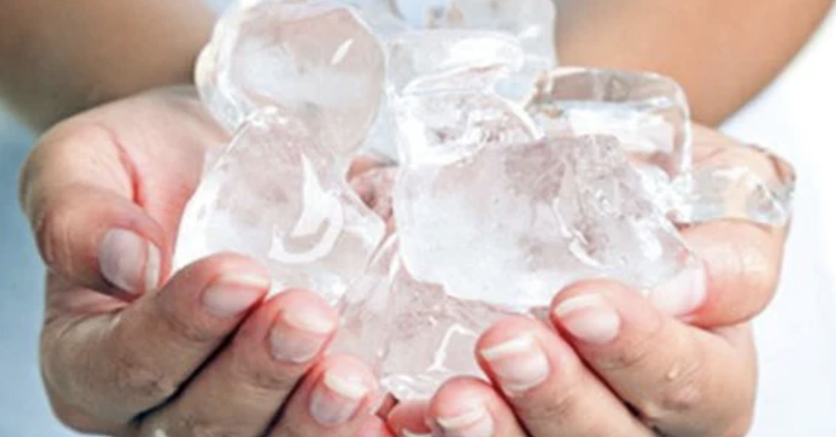 Bị bỏng có nên chườm đá, bôi kem đánh răng?