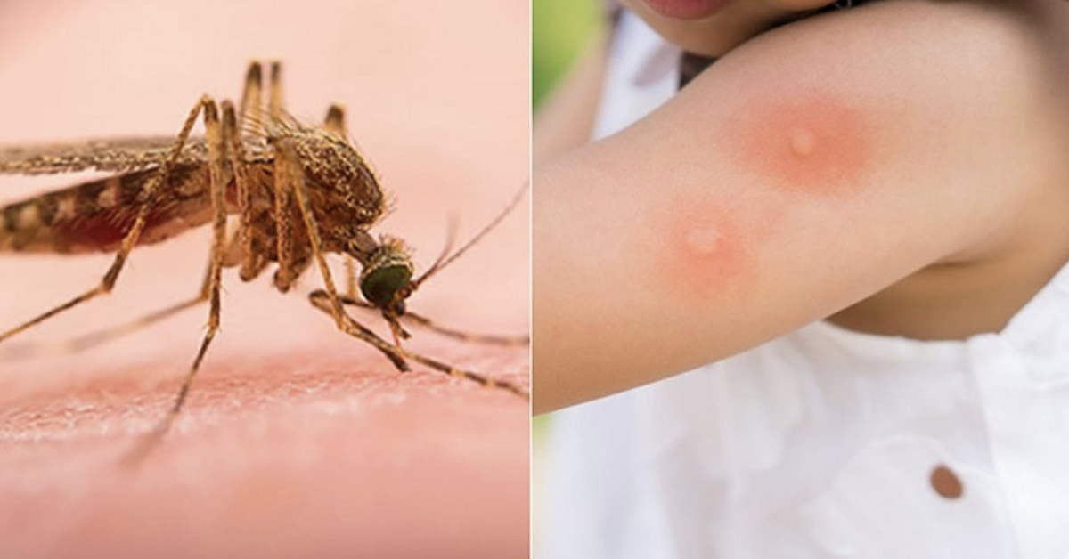 Du xuân an toàn: Cẩn thận côn trùng đốt, túi y tế mang theo cần gì?