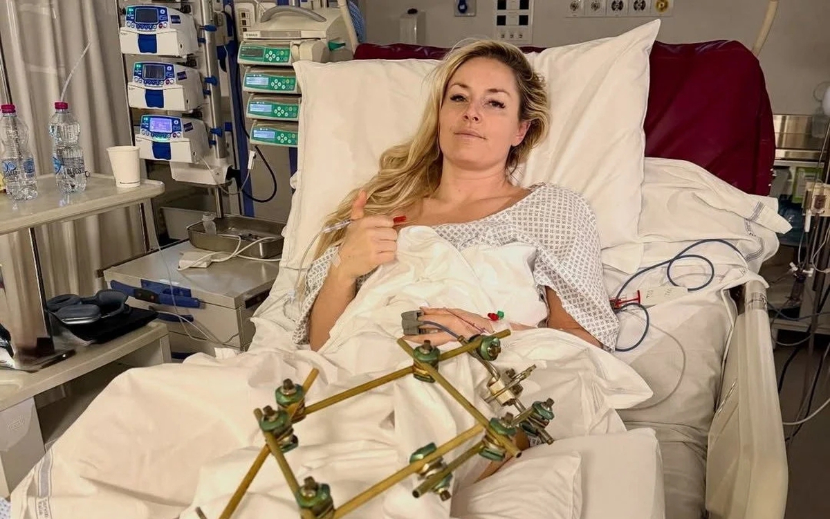 'Nữ hoàng tốc độ' có nguy cơ phải cắt cụt chân sau tai nạn tại Olympic