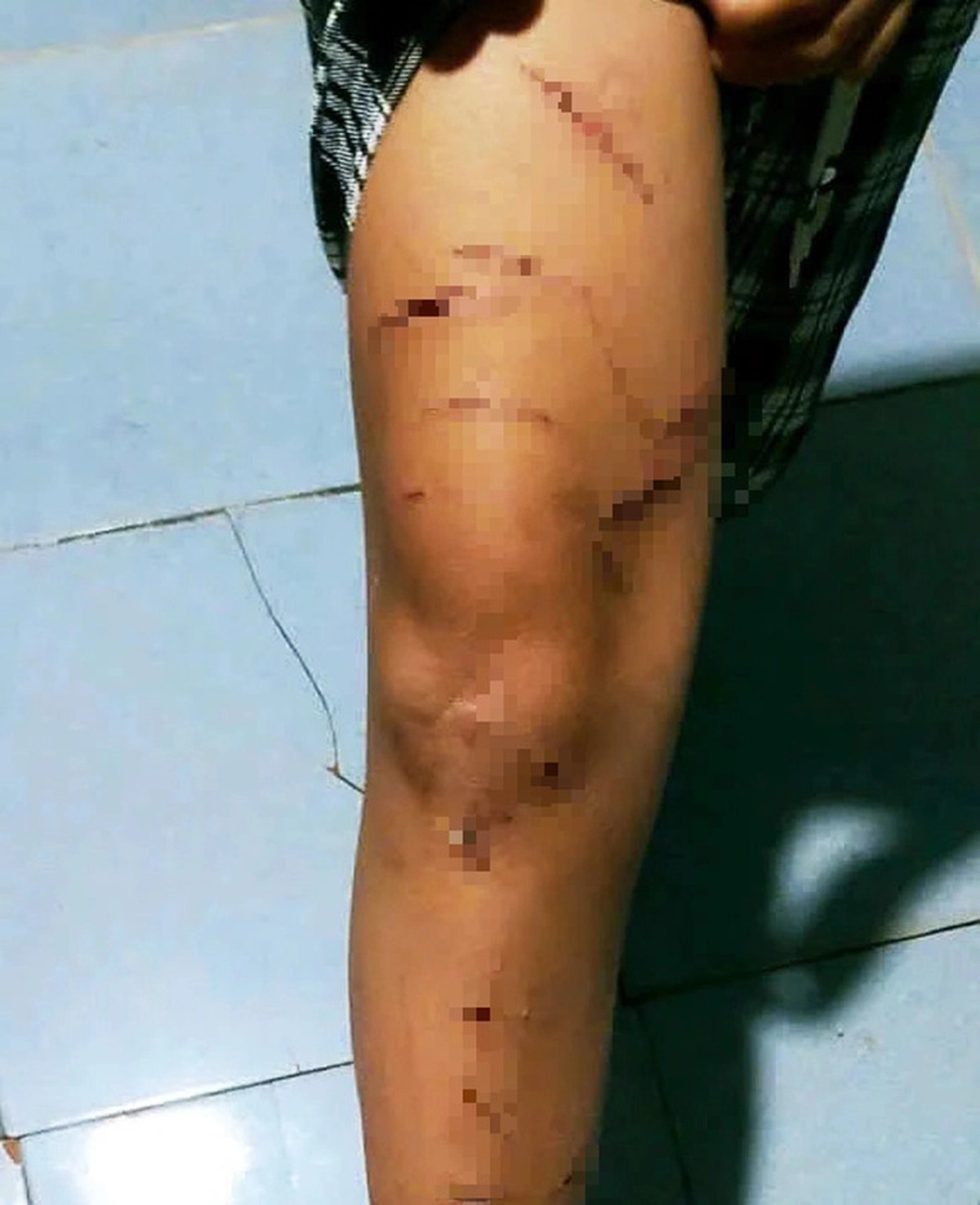 Vụ bé gái bị rạch nhiều vết trên người: Giao 'thủ phạm' cho gia đình, nhà trường quản lý, giáo dục