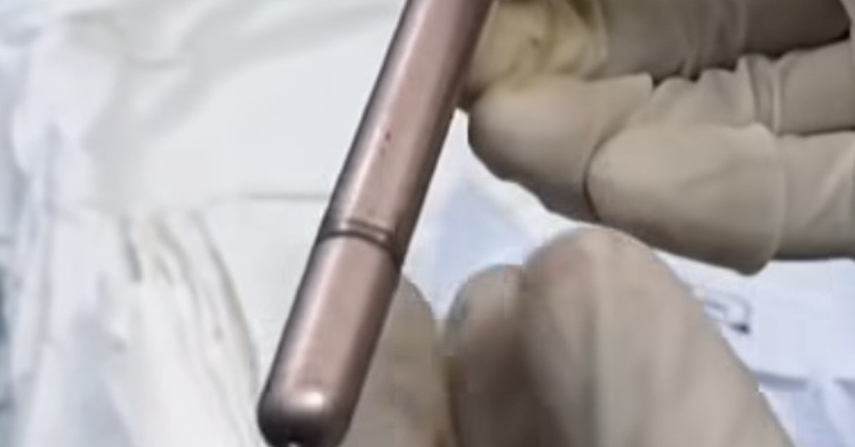 Thiếu nữ 16 tuổi phải cấp cứu ban đêm vì có cây bút trong bàng quang