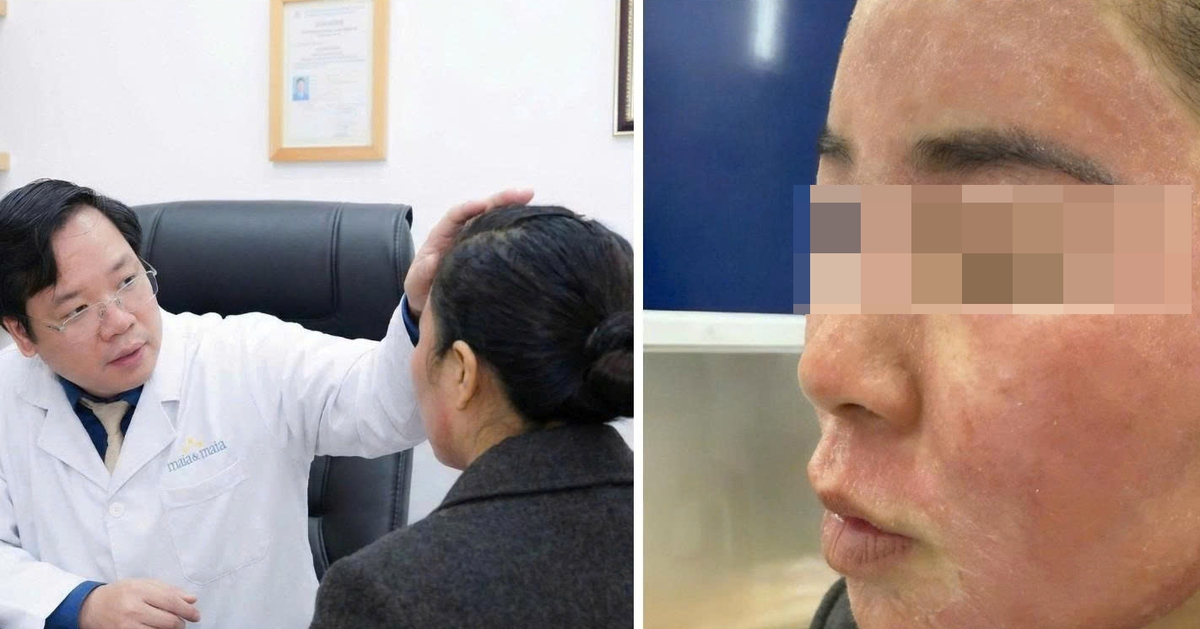 Đang gội đầu được mời ‘làm đẹp cấp tốc’ đón Tết, cô gái hỏng cả khuôn mặt