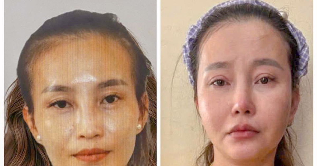 Phẫu thuật thẩm mỹ để trốn truy nã nhưng vẫn bị bắt