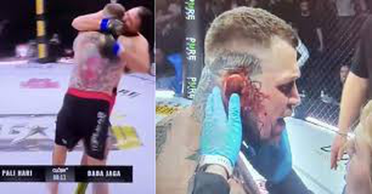 Võ sĩ suýt cắn đứt tai đối thủ ở sàn võ MMA