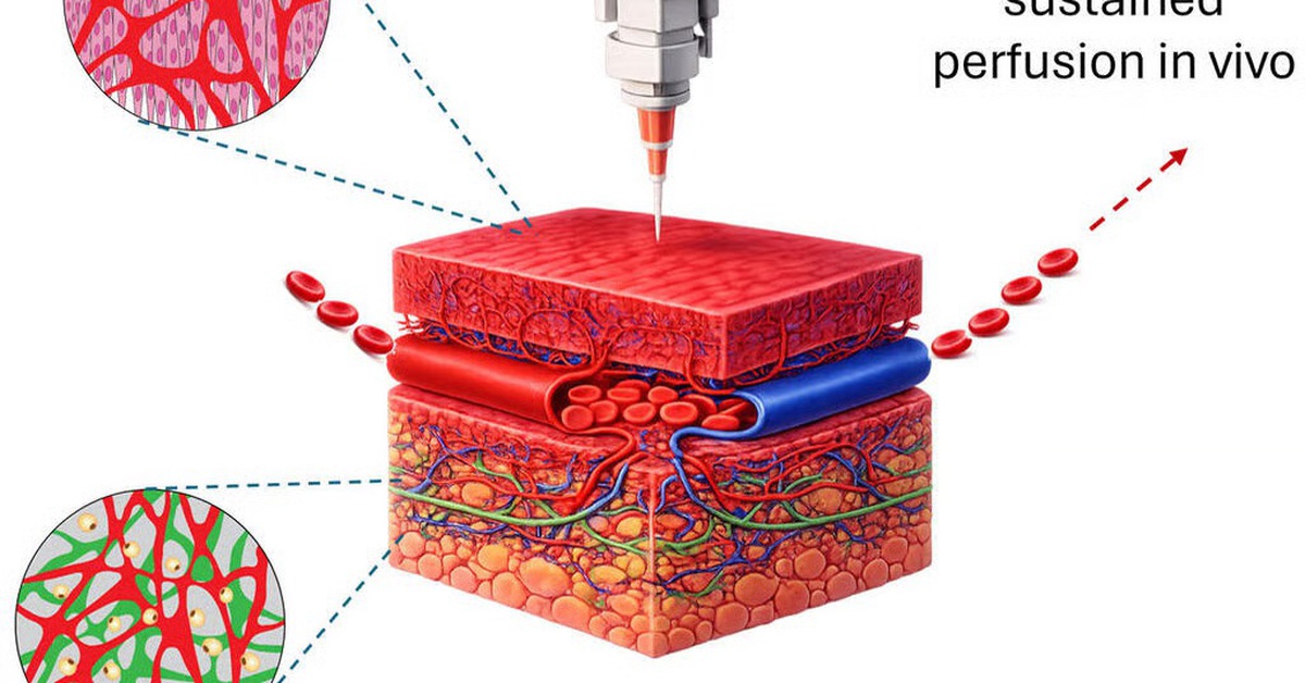 Phát triển mô cấy ghép in 3D giúp phục hồi tổn thương mô nghiêm trọng