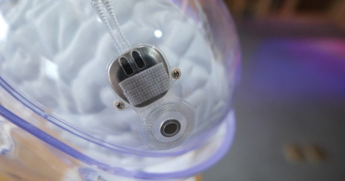 Trung Quốc cấp phép lưu hành đối với thiết bị y tế BMI xâm lấn