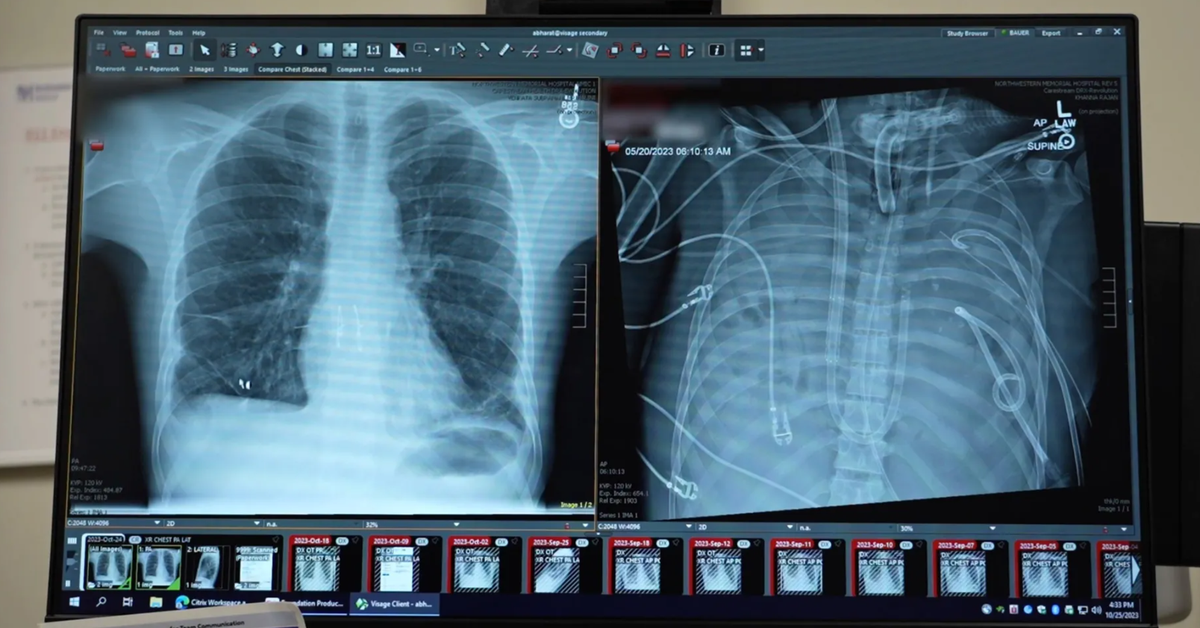 Kỳ tích y khoa: Sống sót 48 giờ không cần phổi