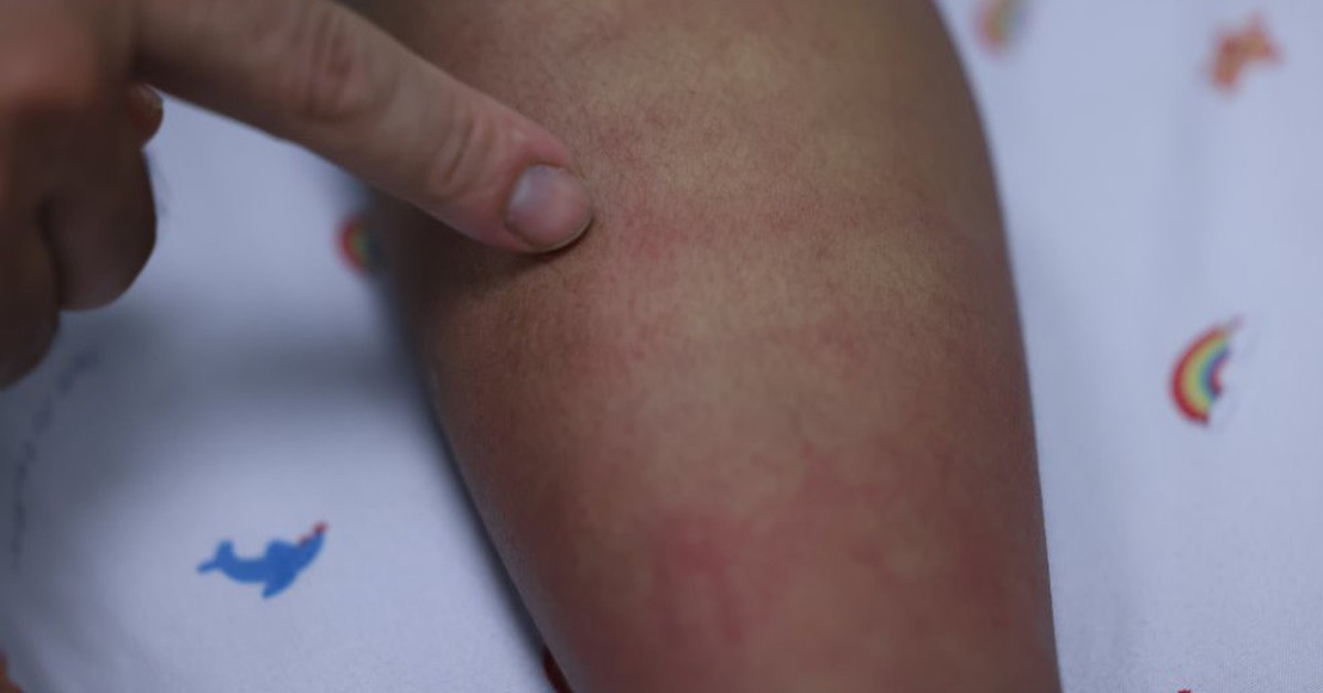 Sốt xuất huyết Dengue và những dự định dở dang bên giường bệnh