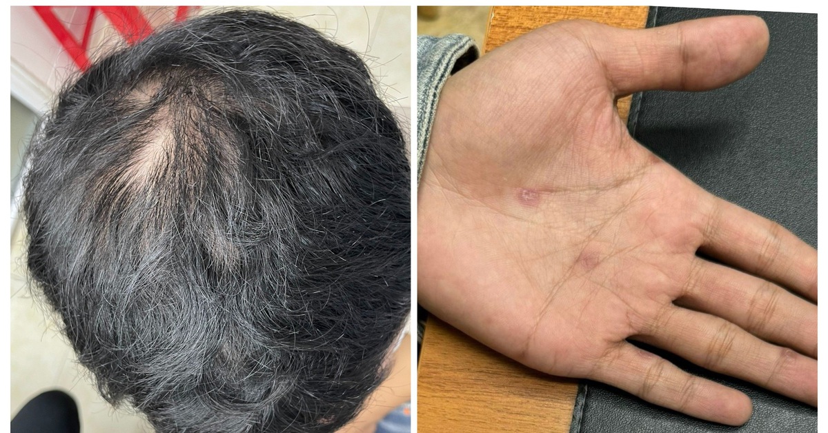 Lo ngại tóc rụng, tóc mỏng, yếu, nhưng bạn có biết loại trái cây giàu dinh dưỡng có lợi cho tóc?