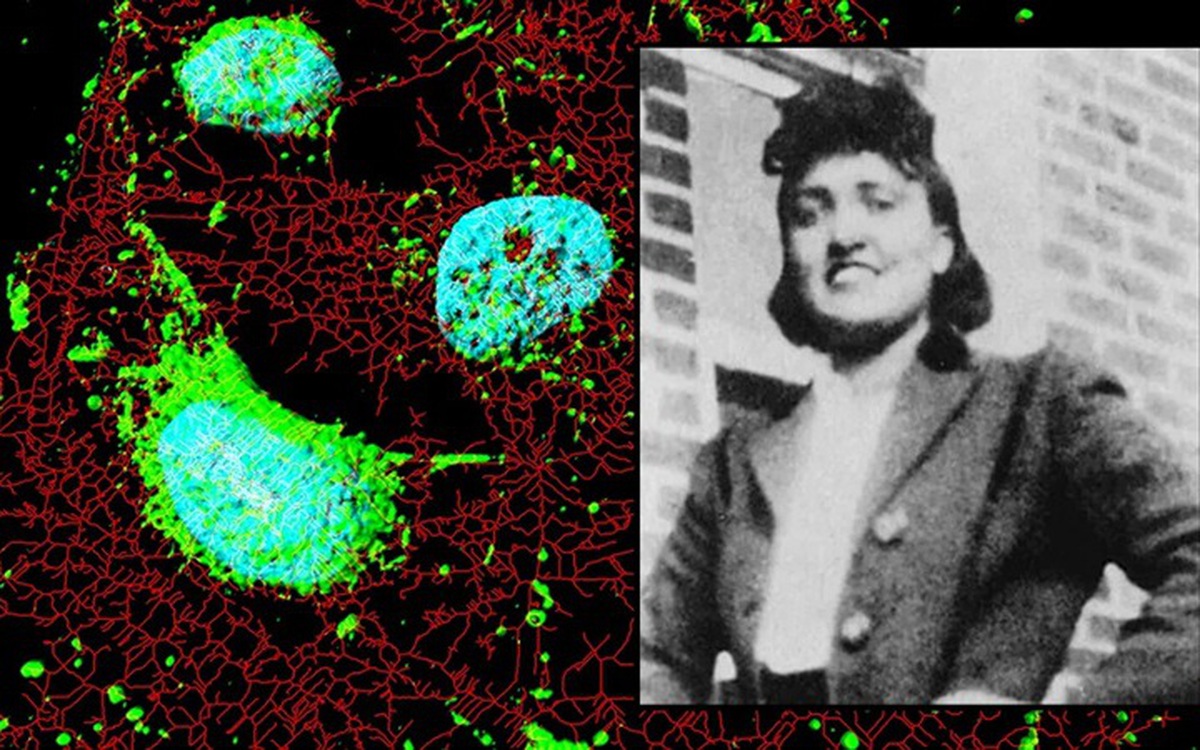 Người phụ nữ qua đời 70 năm nhưng 'tế bào bất tử' vẫn cứu hàng triệu người