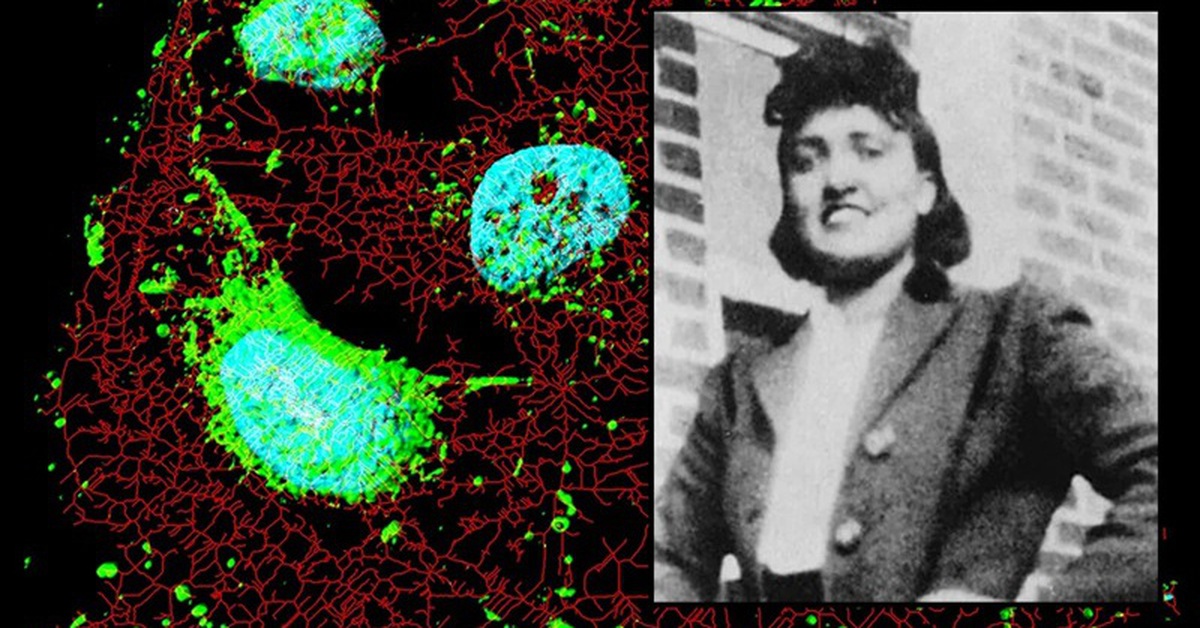 Người phụ nữ qua đời 70 năm nhưng 'tế bào bất tử' vẫn cứu hàng triệu người