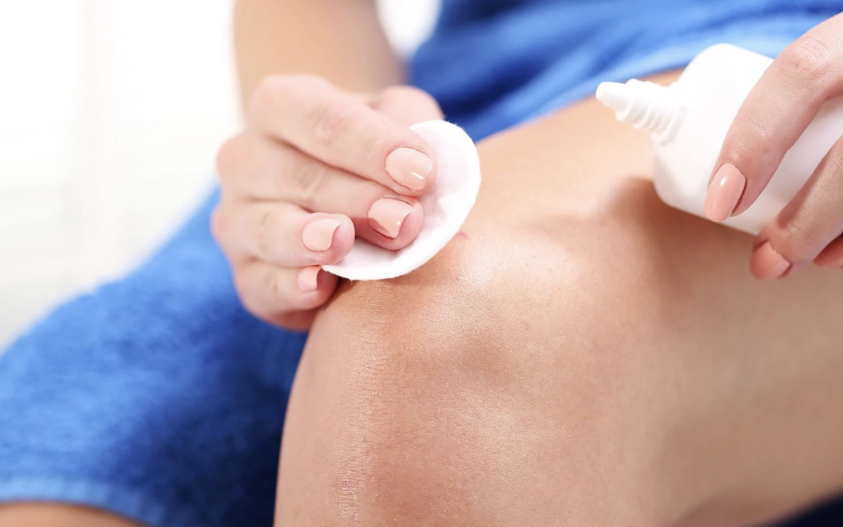 Nhiều người vẫn dùng oxy già để sát trùng vết thương: Có nên không?