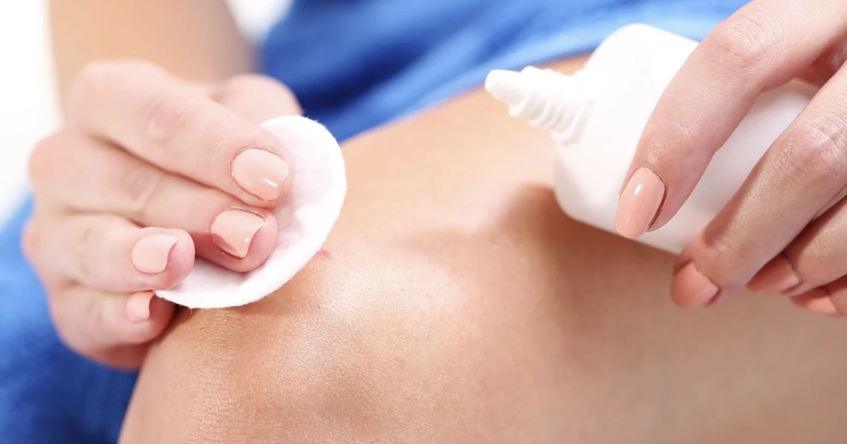 Nhiều người vẫn dùng oxy già để sát trùng vết thương: Có nên không?