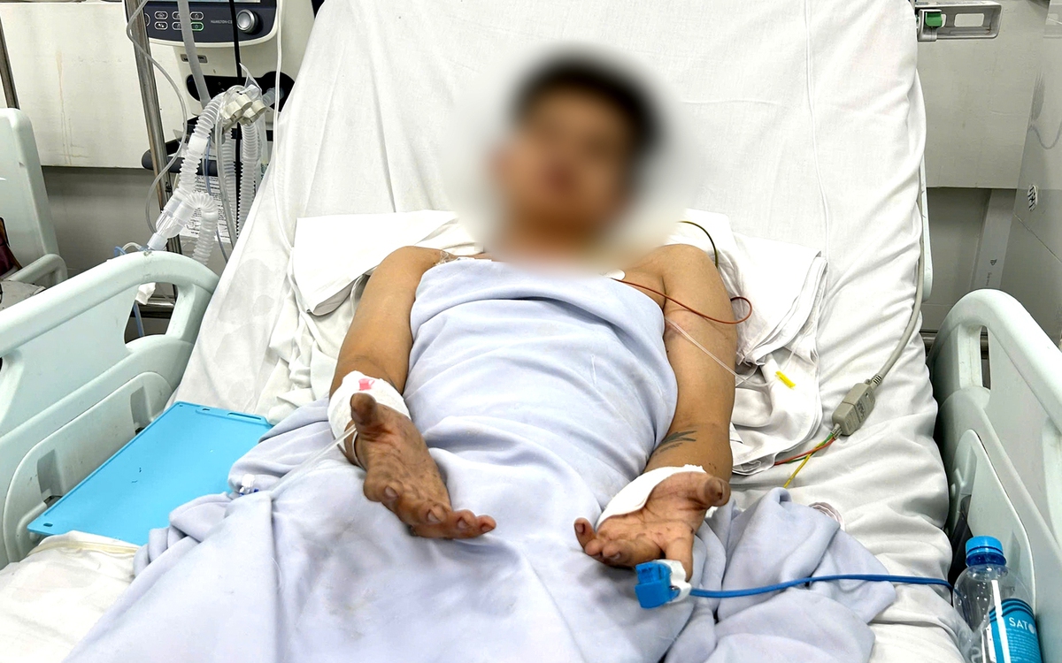 Vụ cháy nhà trọ ở TP.HCM, 2 người tử vong: Nhiều nạn nhân tiên lượng bệnh nặng hồi phục ngoạn mục