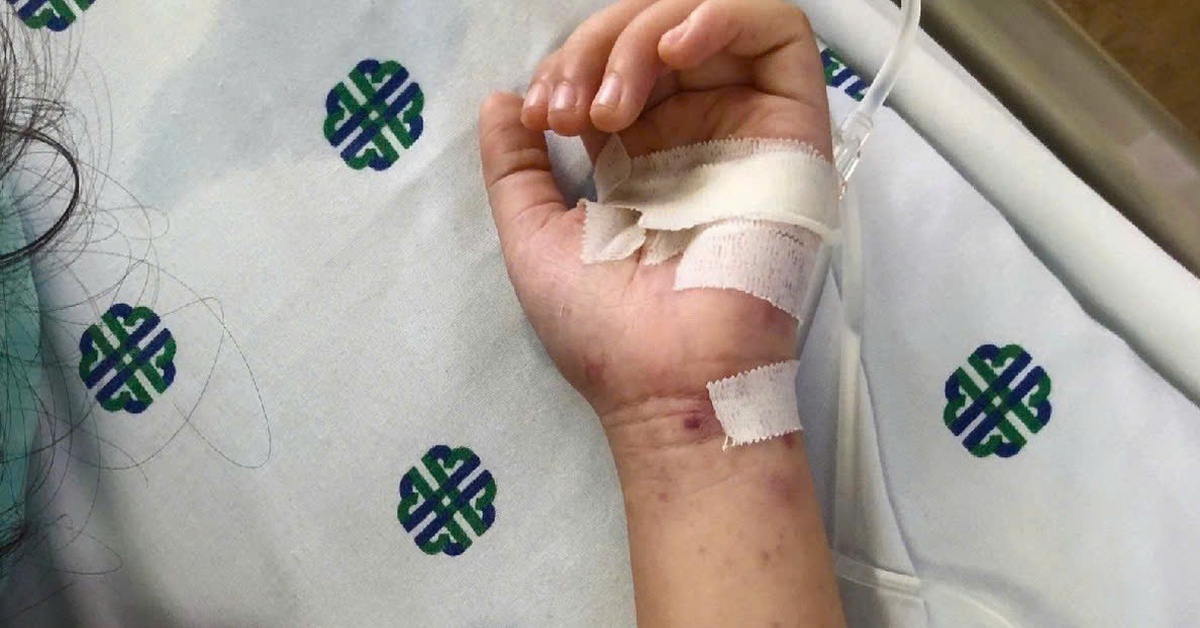 TP.HCM: Bé 11 tuổi tử vong do viêm màng não mô cầu thể tối cấp, diễn tiến rất nhanh