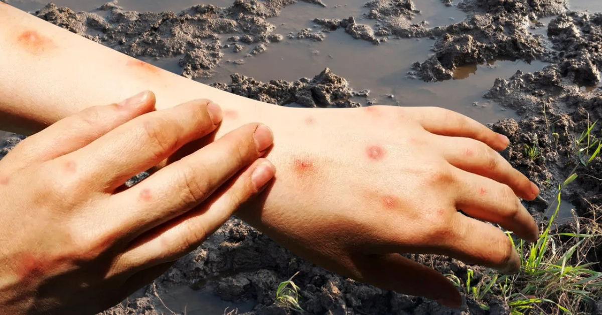 Cảnh giác 'sốt đất' - căn bệnh xuất hiện từ bùn đất