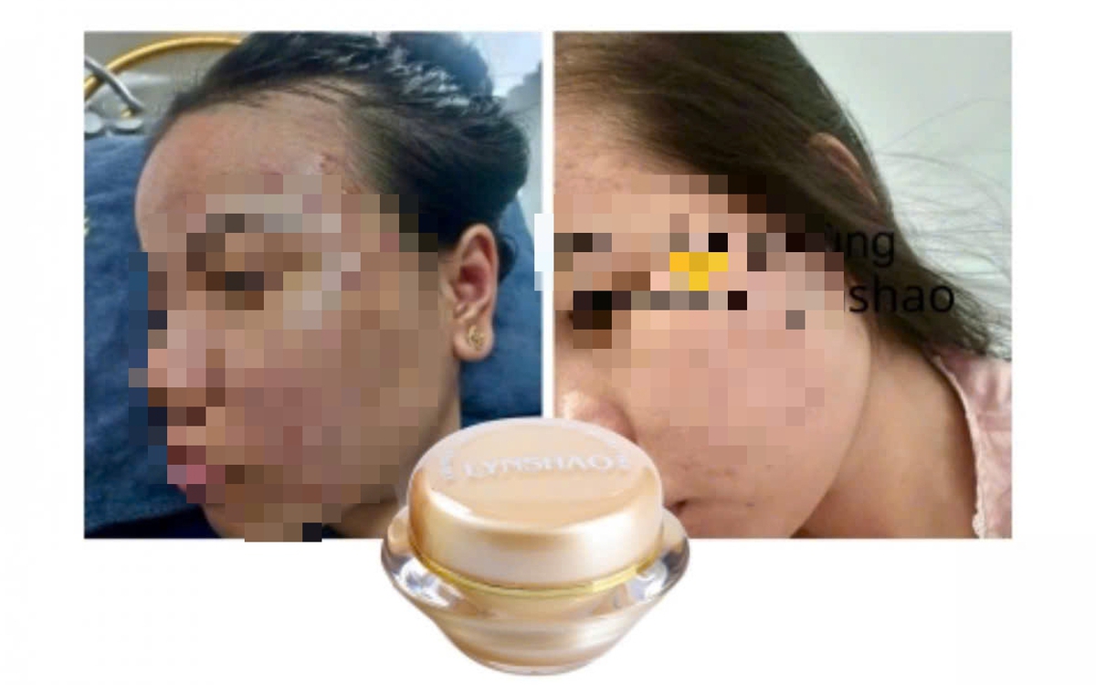 Phát hiện công ty ở TP.HCM sản xuất mỹ phẩm chứa chất cấm Dexamethason, tiêu hủy 107 lô