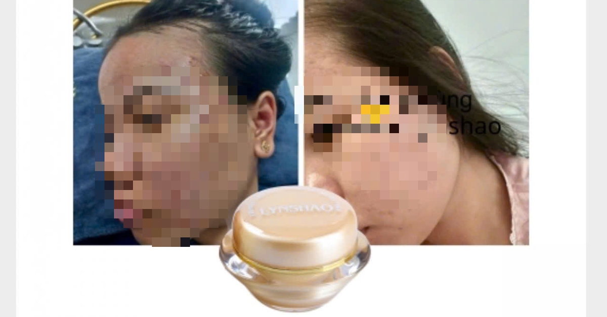 Phát hiện công ty ở TP.HCM sản xuất mỹ phẩm chứa chất cấm Dexamethason, tiêu hủy 107 lô