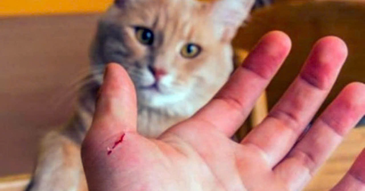 TP.HCM đã có 3 ca tử vong do bệnh dại, nắng nóng có thể làm gia tăng nguy cơ mắc bệnh dại