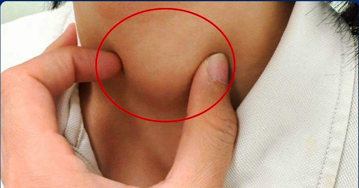 Viêm tuyến giáp có làm tăng nguy cơ ung thư?