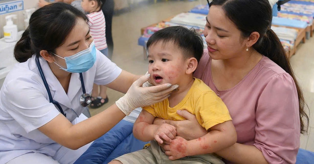 Tay chân miệng ở Đà Nẵng tăng nhanh, vượt ngưỡng trung bình nhiều năm