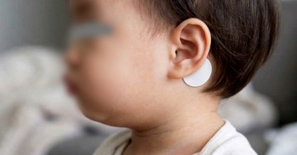 Nguy hiểm miếng dán chống say tàu xe, nhiều người chưa biết
