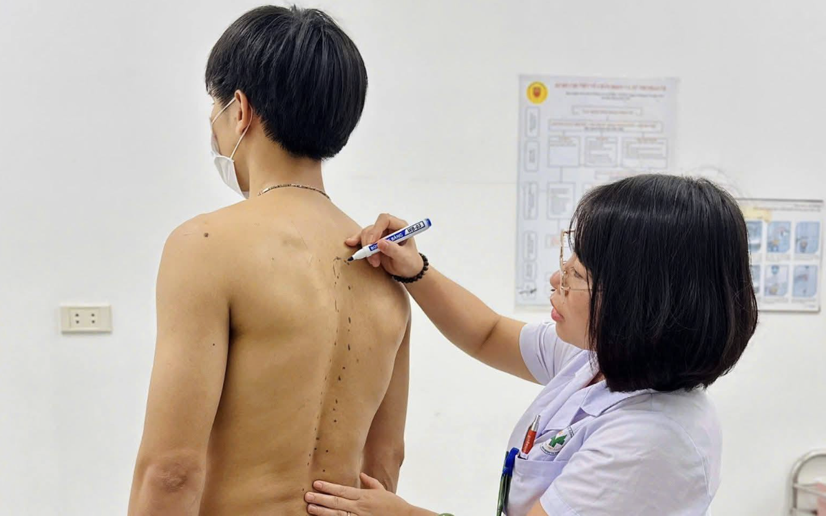 Bác sĩ cảnh báo dấu hiệu đau lưng bất thường không nên bỏ qua