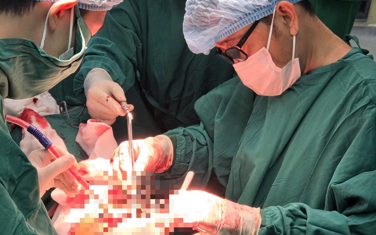 Nghẹt thở cứu ca đứt lìa động mạch cổ, ngưng tim: Ép tim 20 phút, vừa mổ vừa hồi sức