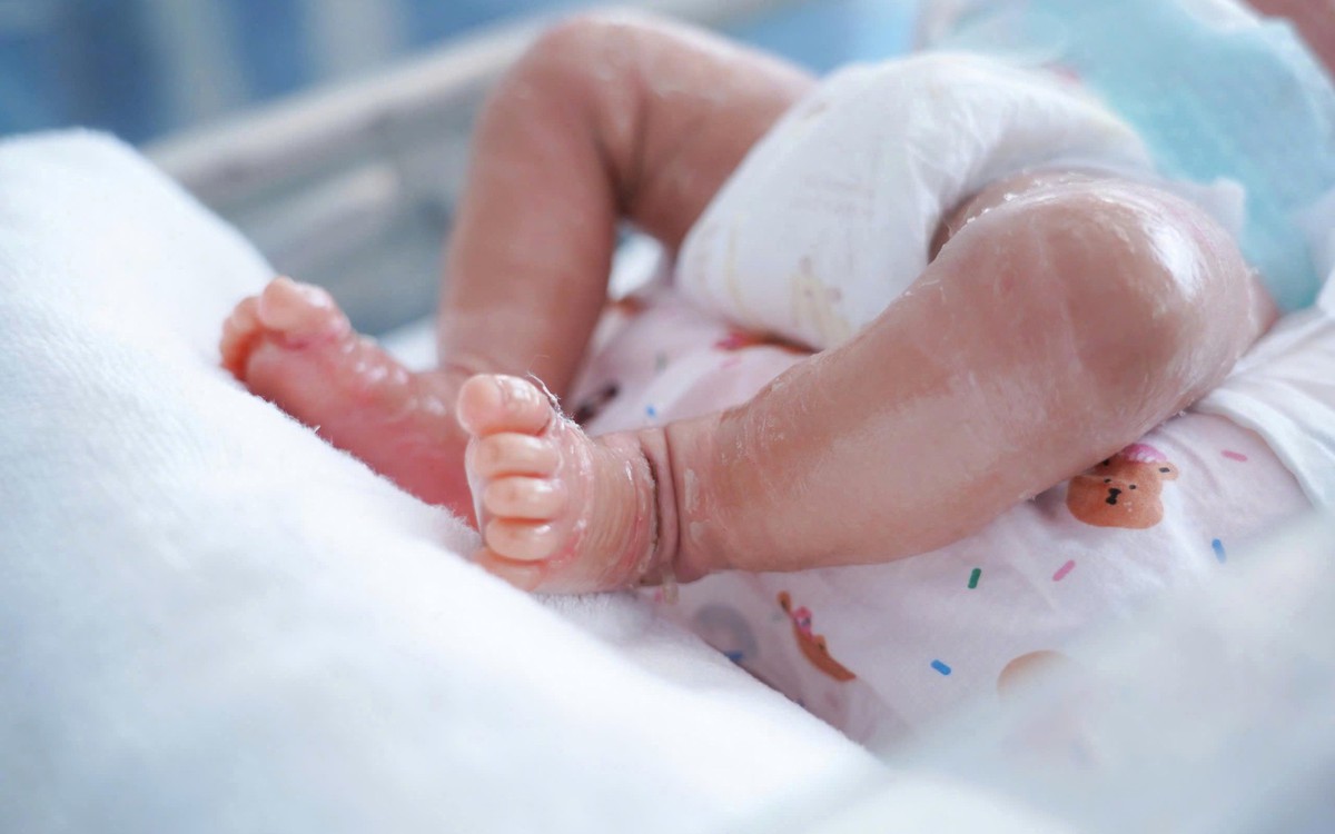 Da bé trai sơ sinh khô nứt bất thường, bác sĩ phát hiện mắc bệnh vảy cá hiếm gặp