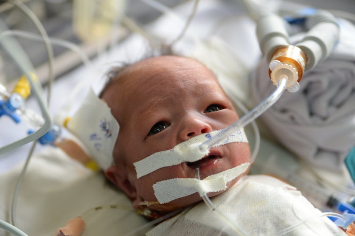 Mổ tim cho bé trai nặng 2kg - Tuổi Trẻ Online