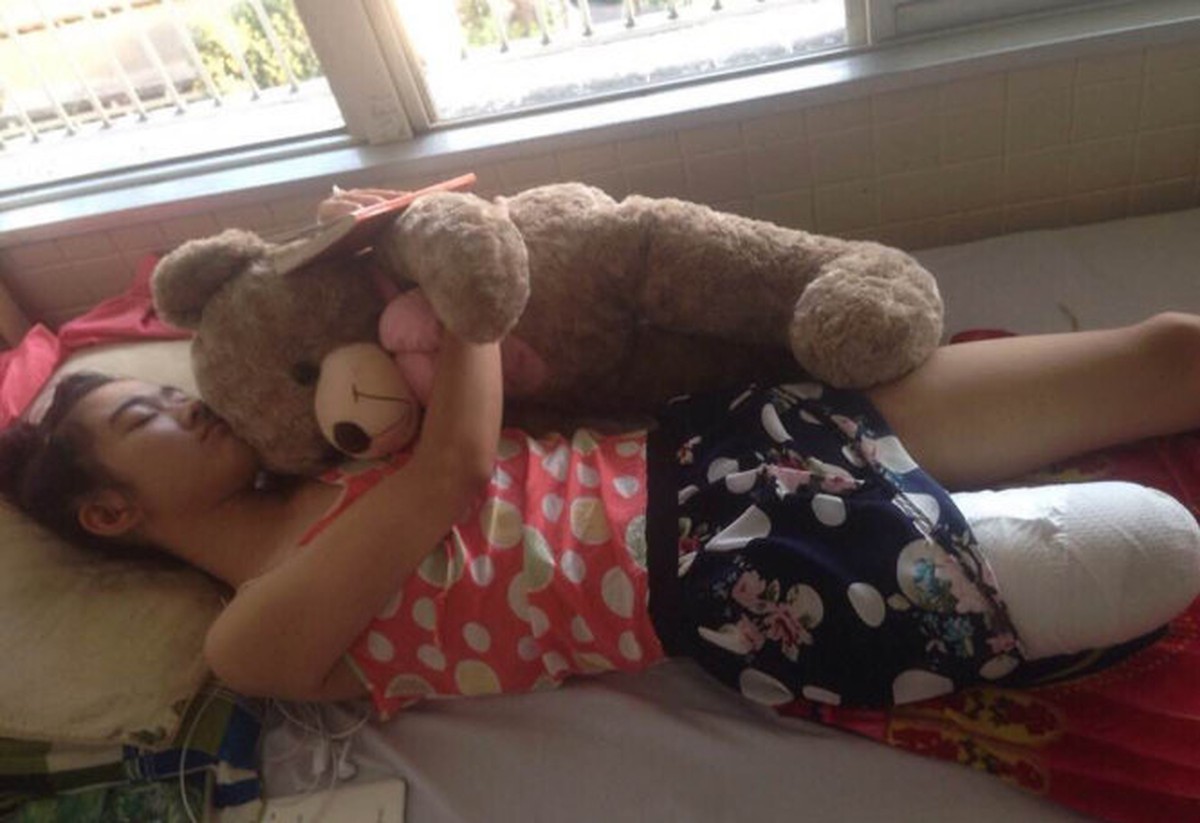 Gia đình nữ sinh bị cưa chân đòi bệnh viện bồi thường