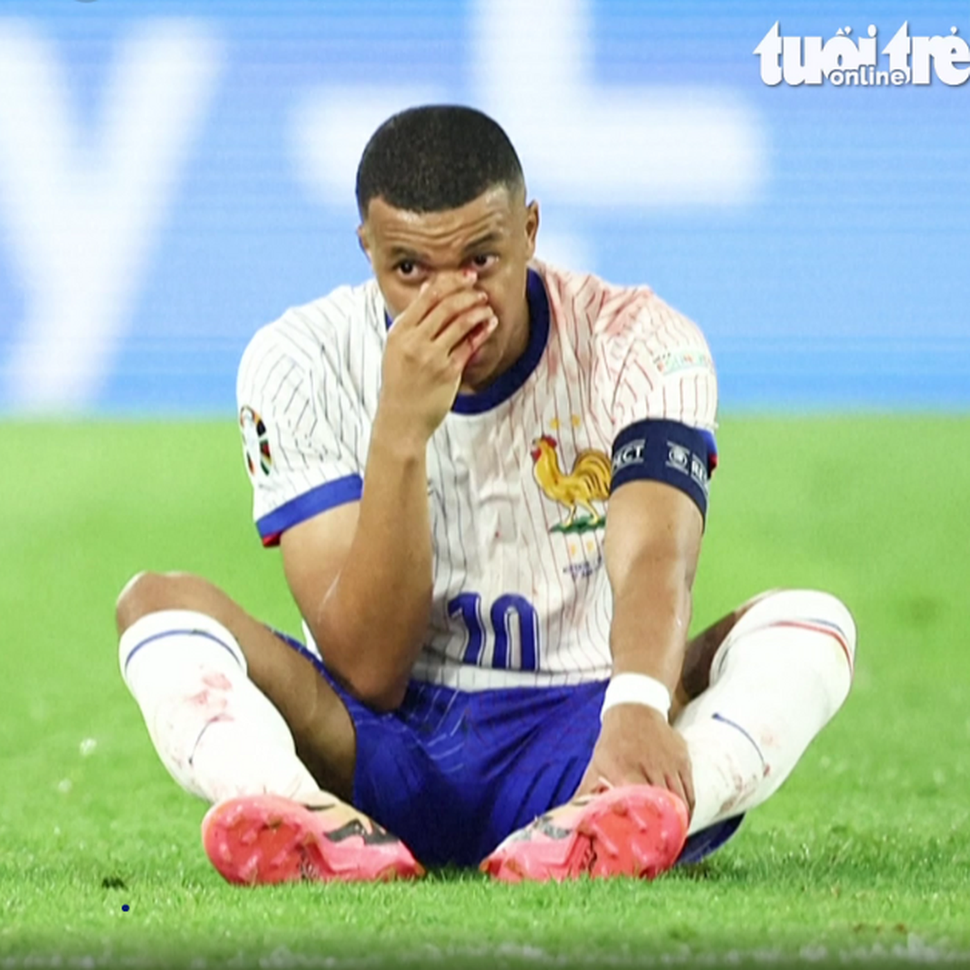 Mbappe lãnh thẻ và gãy mũi ngay trong trận đầu ra quân ở Euro 2024