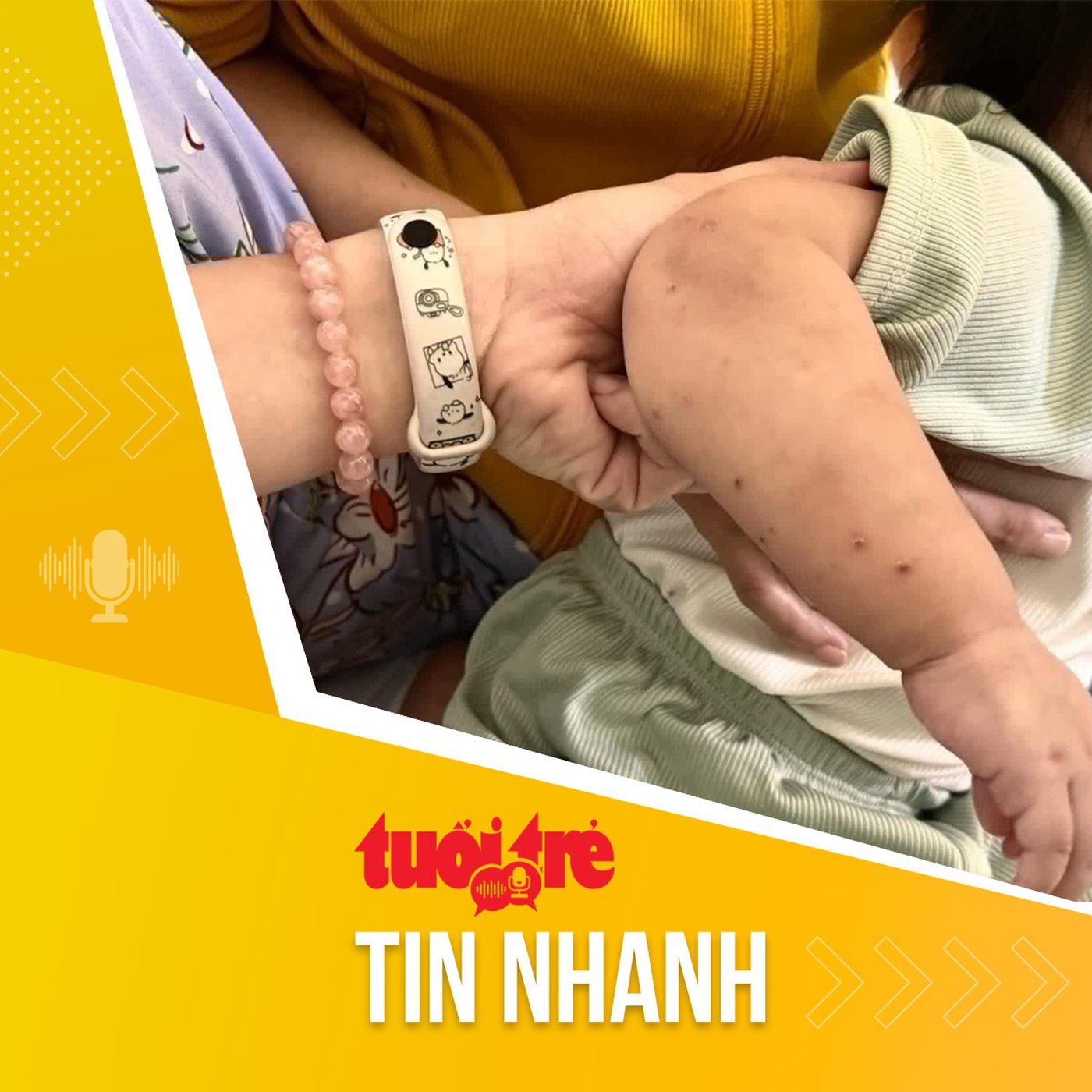 Tin tức sáng 30-10: TP.HCM giám sát 12 trường mầm non, phát hiện 8 trường có ổ dịch tay chân miệng