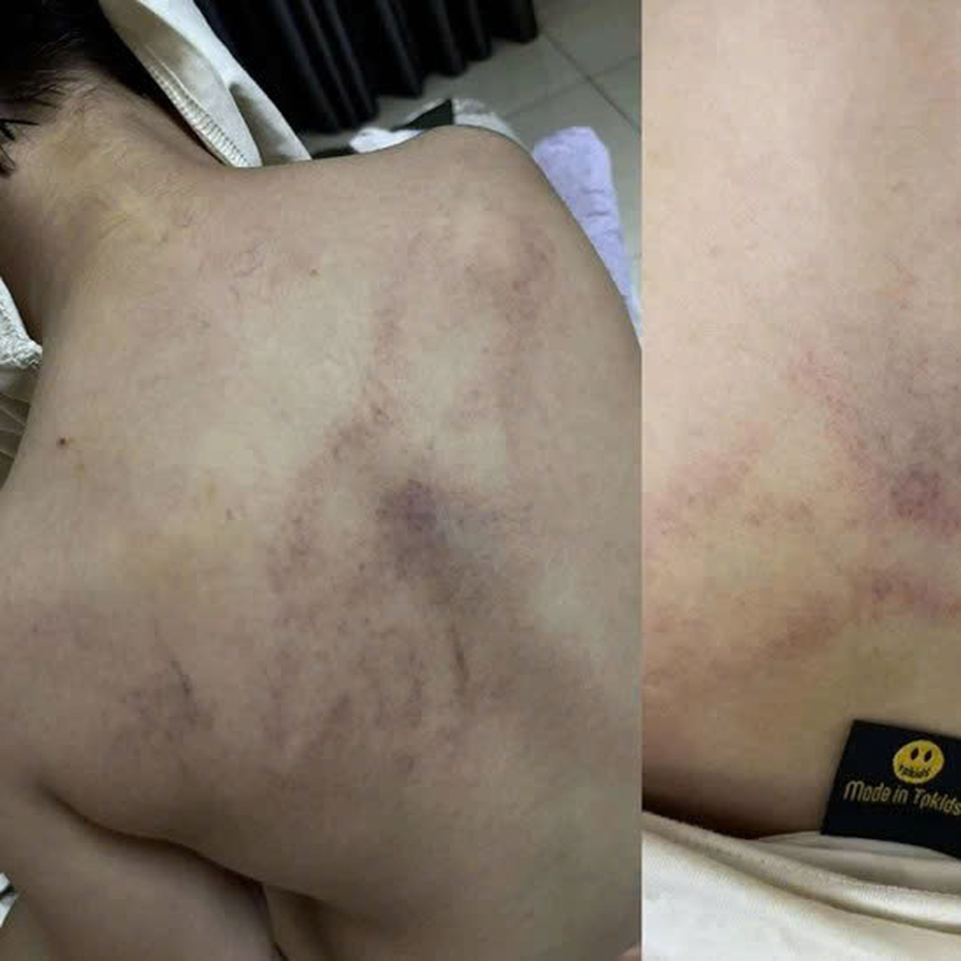 Lời của người cha tố cô giáo mầm non đánh, kéo lê, ném bé gái 4 tuổi vào tường