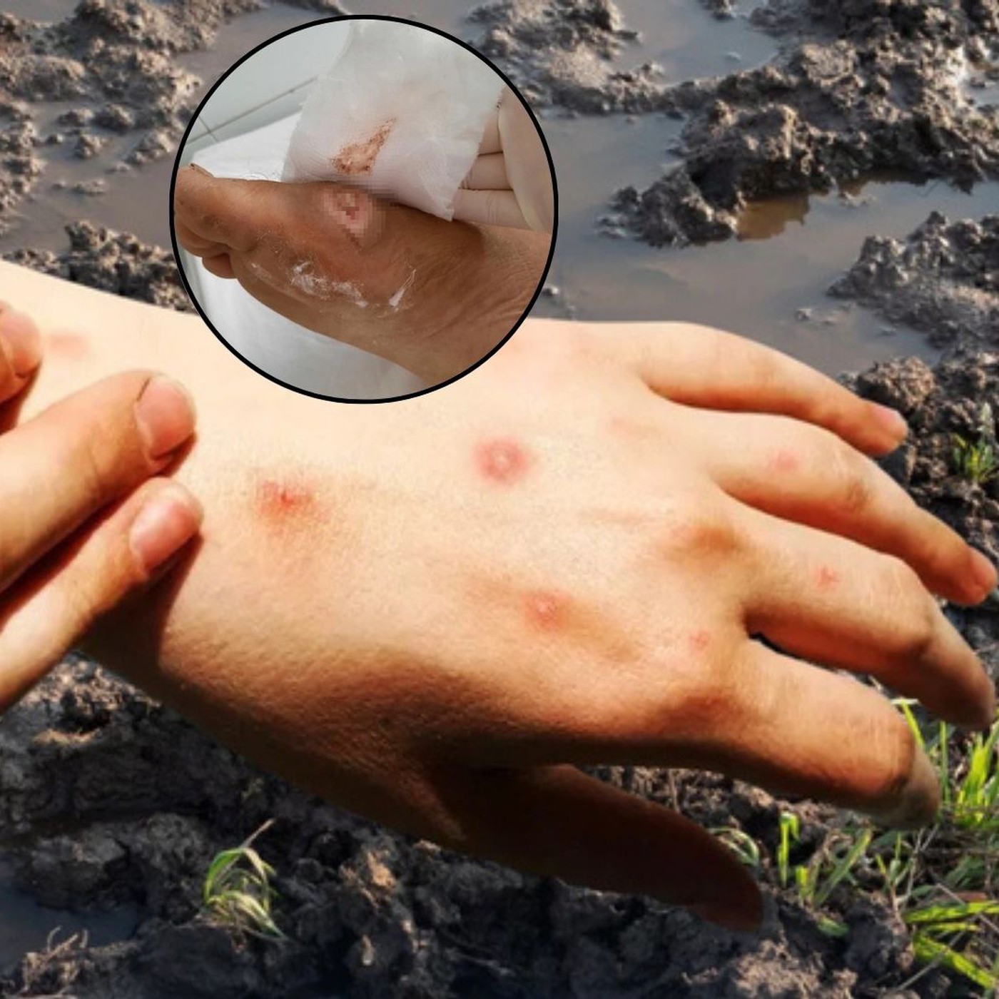 Bộ Y tế khuyến cáo 8 biện pháp phòng bệnh ‘sốt đất’ sau 23 ca tử vong ở Thái Lan