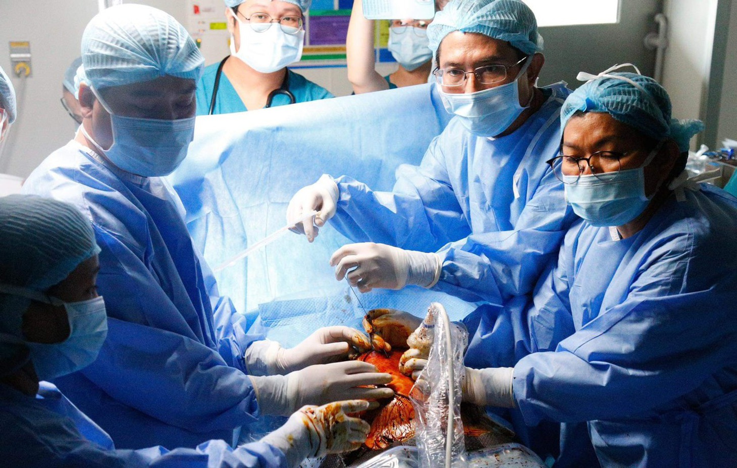 Ê kíp bác sĩ Bệnh viện Từ Dũ và Bệnh viện Nhi đồng 1 thông tim bào thai cho chị L. thành công - Ảnh: Bệnh viện cung cấp