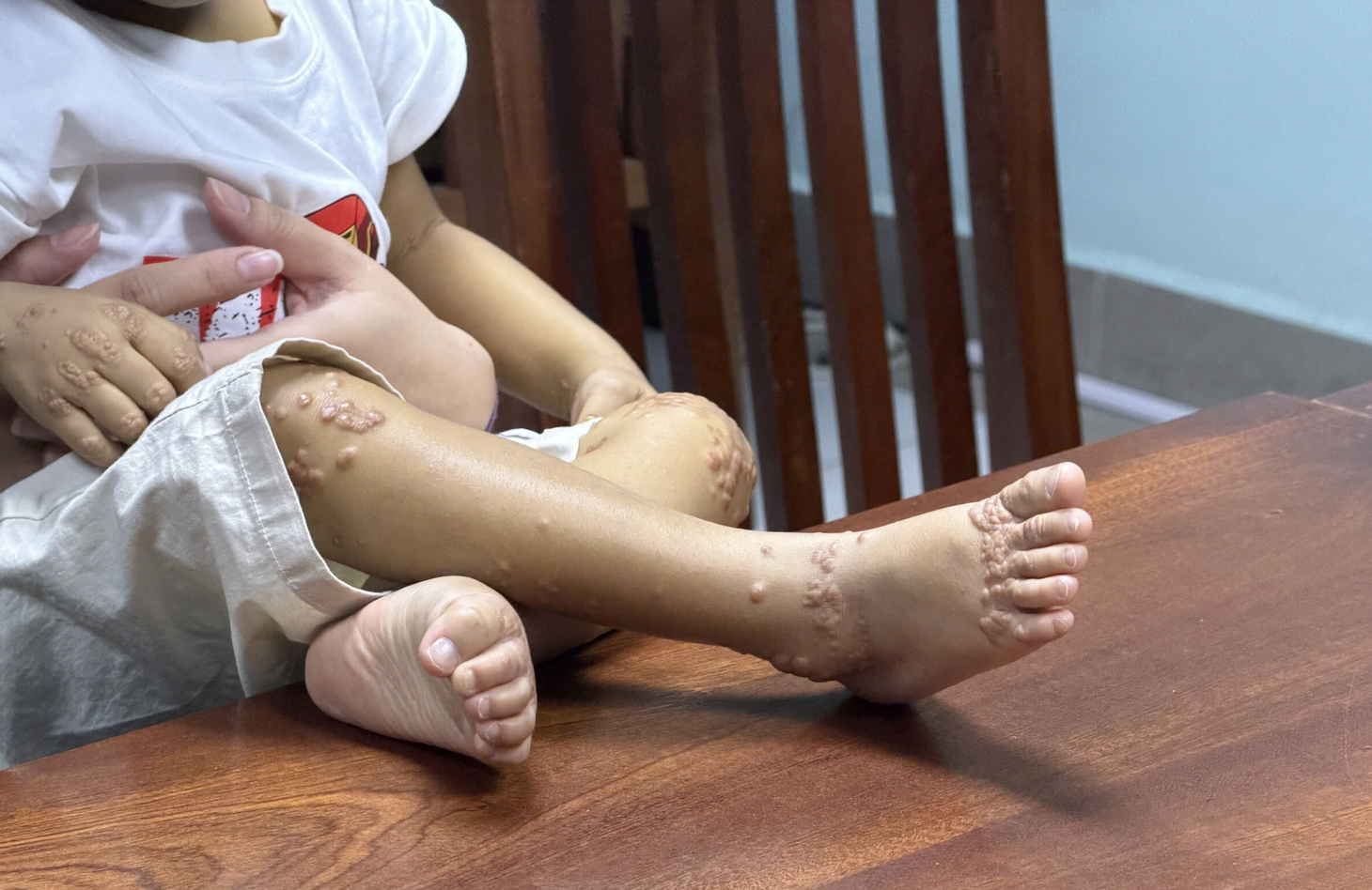Nỗi sợ bị xa lánh của trẻ mắc hội chứng Alagille - Ảnh 2.