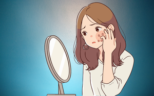 Miếng dán mụn có thật sự thần kỳ như lời đồn?- Ảnh 4.