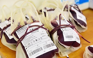 Vietnam faces urgent need for 122,000 blood units in January-March- Ảnh 3.