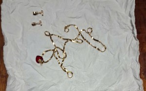 Patient reunited with lost gold jewelry at Ho Chi Minh City hospital- Ảnh 2.