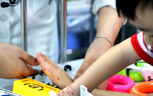 Ho Chi Minh City reports over 44,000 hand, foot and mouth disease cases, 60 samples test positive for EV71 - Ảnh 3.