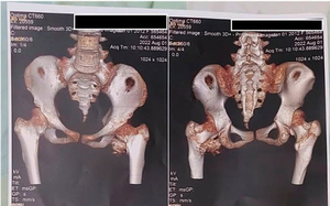 The difficult journey of Vietnamese children living with rare Alagille syndrome - Ảnh 8.