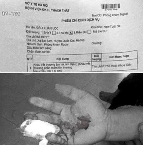 Lỗi đánh máy khiến bệnh nhân nam bị chỉ định khâu... âm đạo - Ảnh 1. Lỗi đánh máy khiến bệnh nhân nam bị chỉ định khâu... âm đạo - Ảnh 1.
