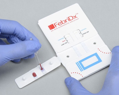 Xét nghiệm FebriDx: Giúp giảm vấn nạn siêu vi khuẩn kháng thuốc - Ảnh 1. Xét nghiệm FebriDx: Giúp giảm vấn nạn siêu vi khuẩn kháng thuốc - Ảnh 1.