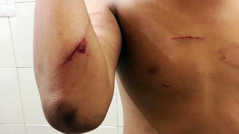 Trà Vinh: bé trai 8 tuổi bị cha dượng đánh đập dã man - Ảnh 2.