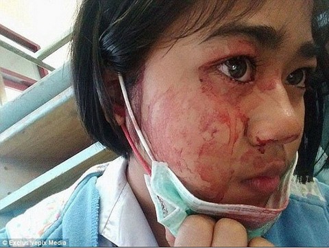 Vắt sức làm tới đổ mồ hôi máu, có thật không? - Ảnh 4. Vắt sức làm tới đổ mồ hôi máu, có thật không? - Ảnh 4.